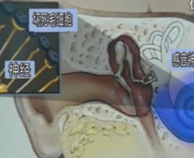 感谢民生耳鼻喉医院给我带来声音